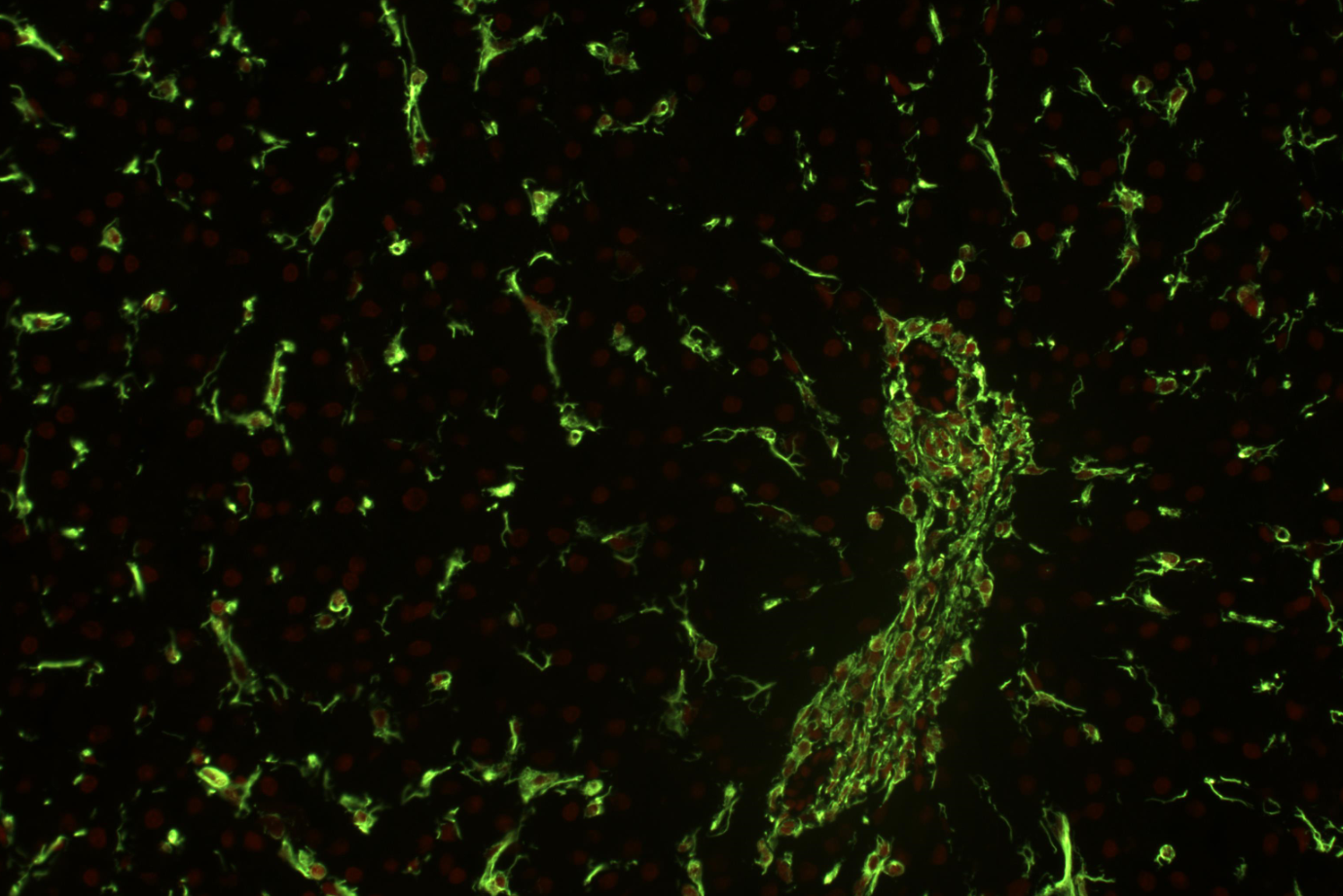 Vimentin antibody