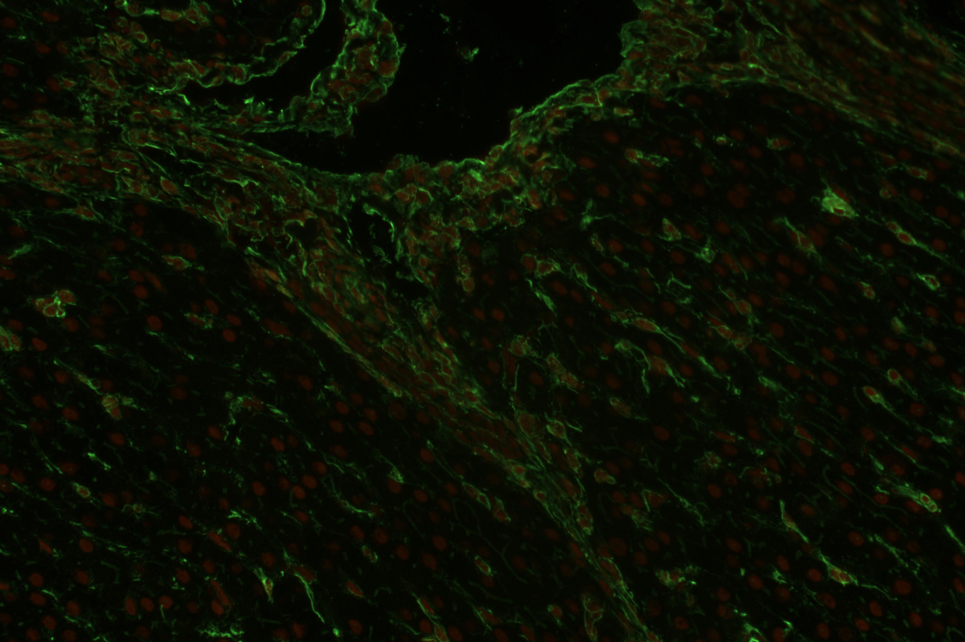 Vimentin antibody