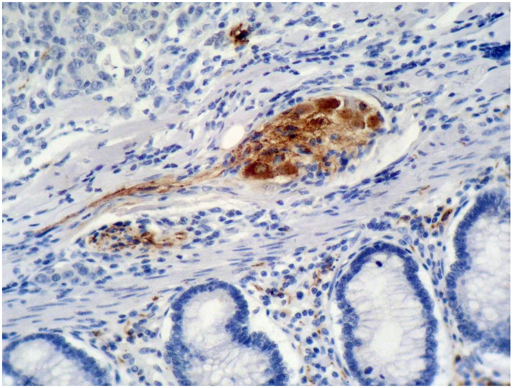p21Waf1 Antibody