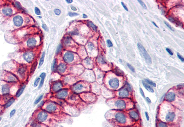 EpCAM antibody