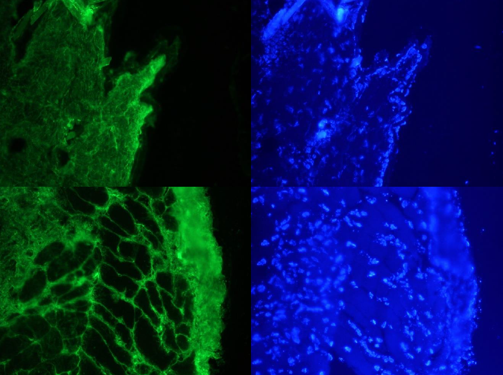 Fibronectin, mouse Antibody