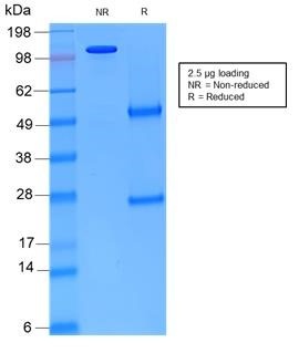 Vimentin antibody