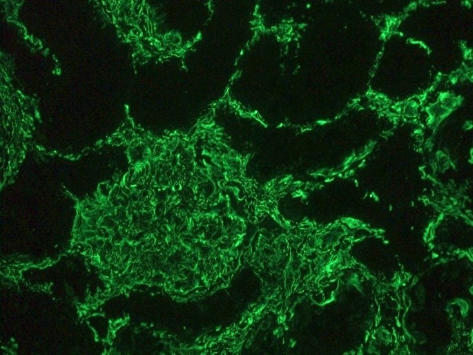 Vimentin antibody