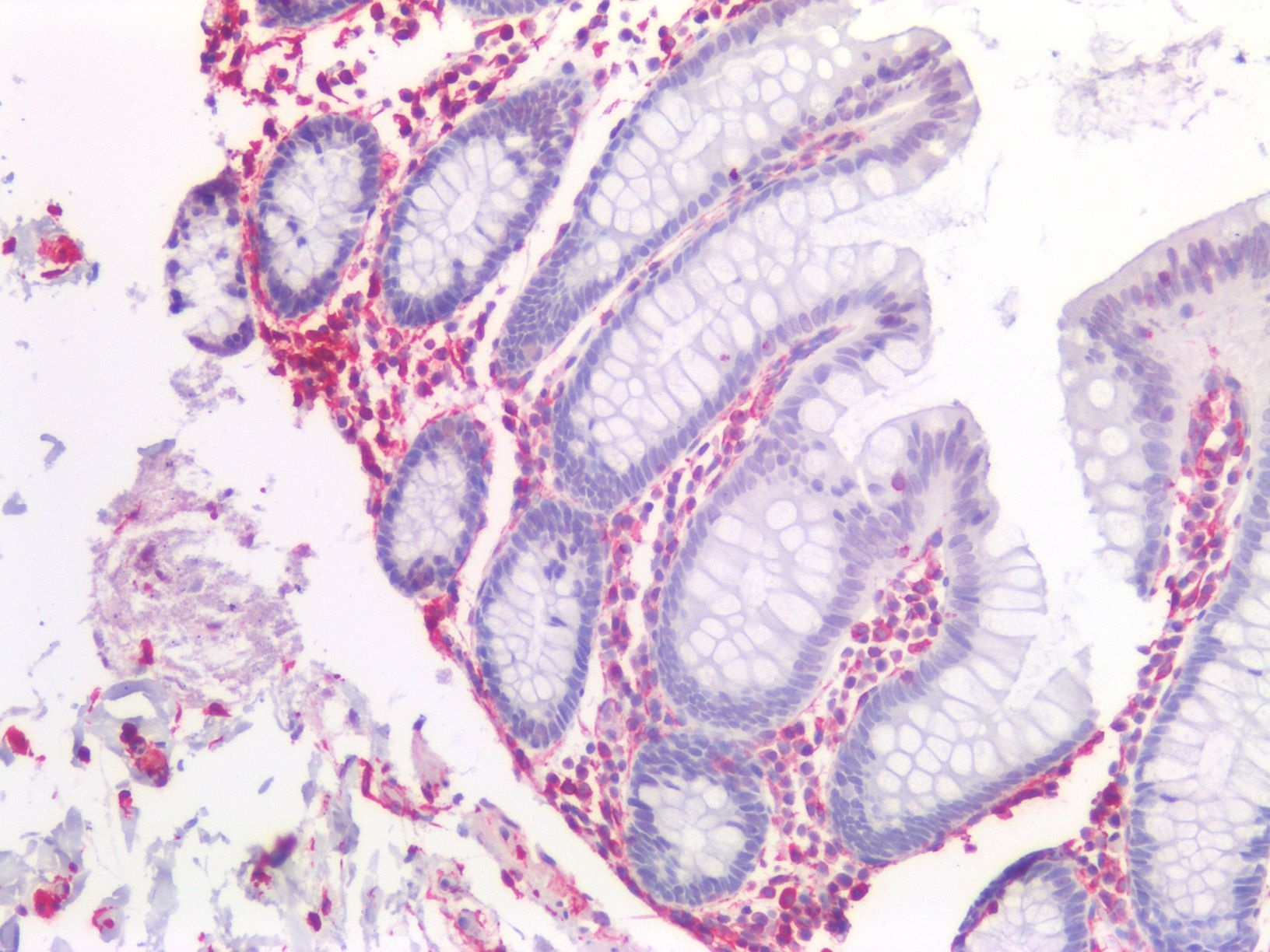 Vimentin antibody