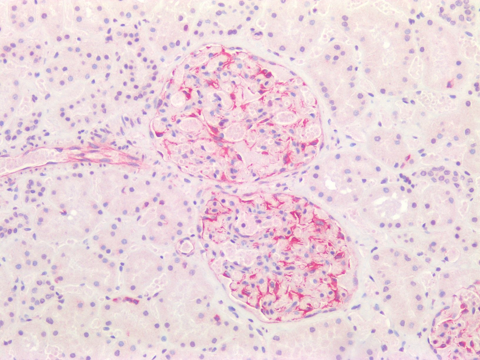 Vimentin antibody