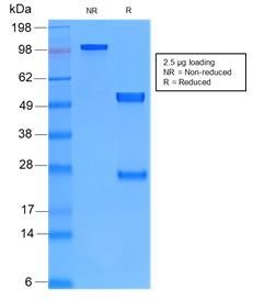 Vimentin antibody