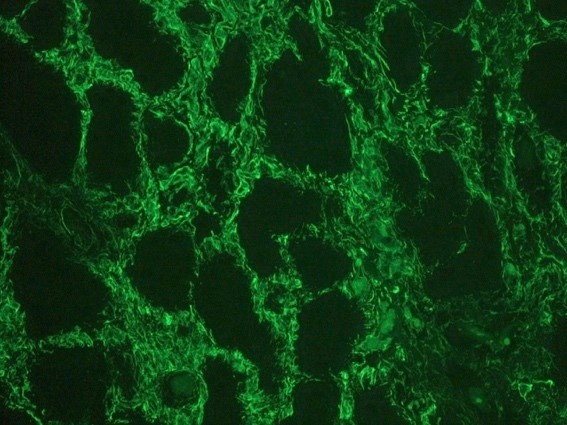 Vimentin antibody