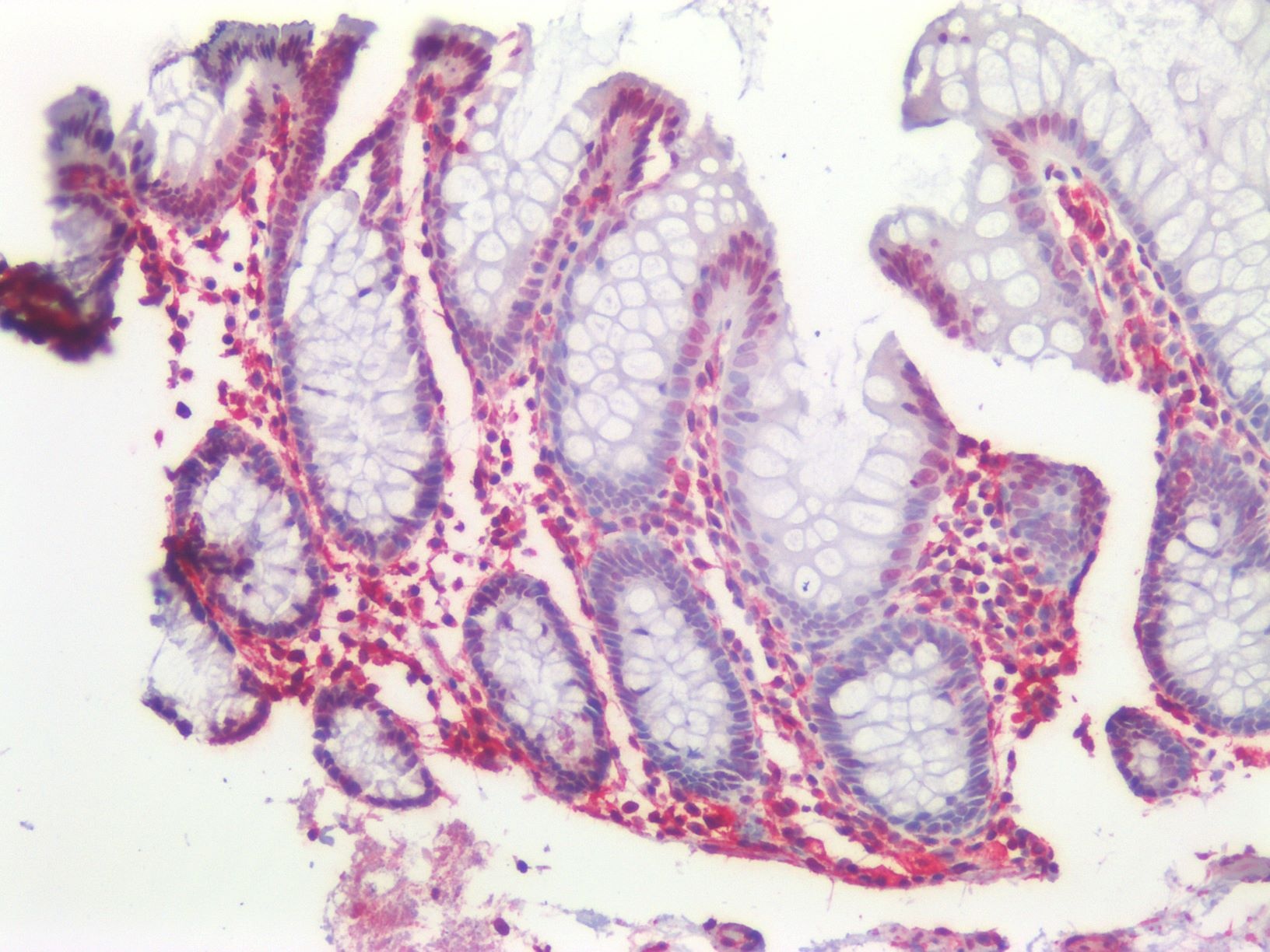 Vimentin antibody