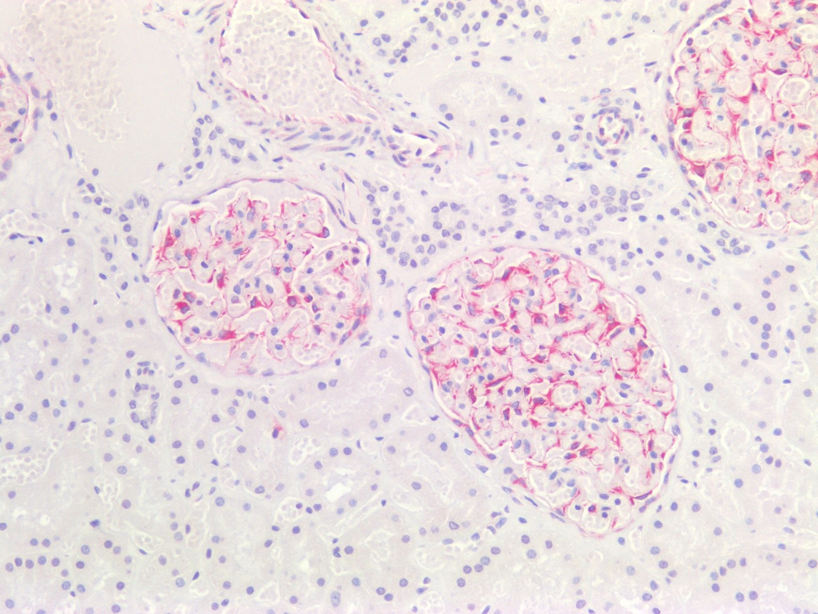 Vimentin antibody