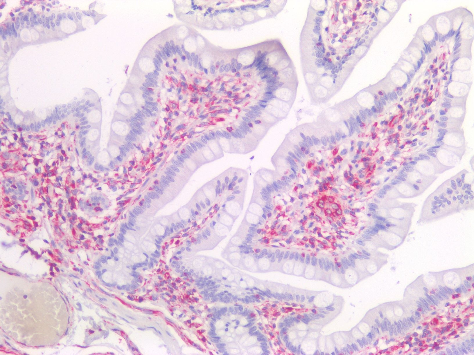 Vimentin antibody