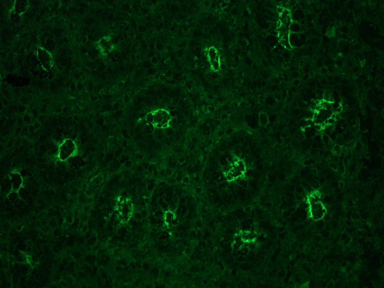 Mouse anti actin gamma-cytoplasmic