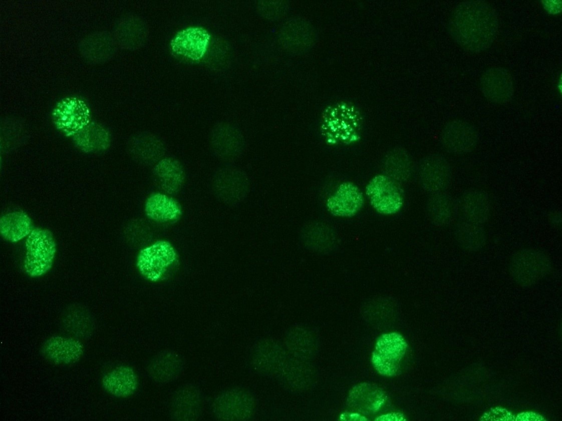 Mouse anti Bromodeoxyuridine / BrdU