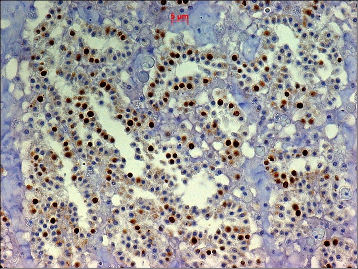 Mouse anti Bromodeoxyuridine / BrdU