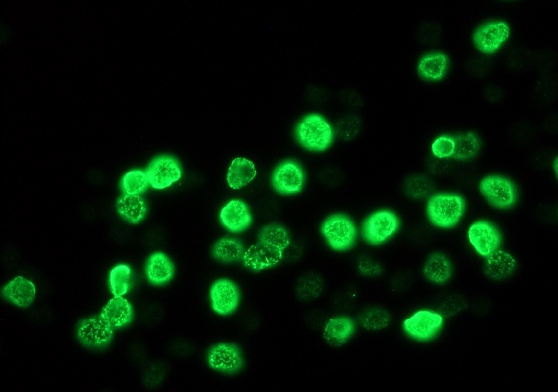 Mouse anti Bromodeoxyuridine / BrdU