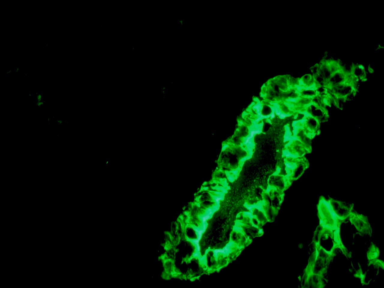 Mouse anti Cytokeratin 7 / Keratin K7