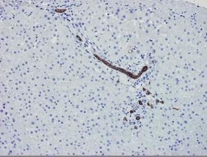 Mouse Cytokeratin 7 / Keratin K7 Antibody
