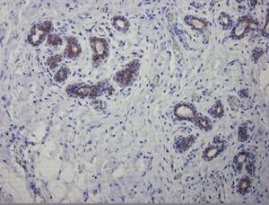 Mouse Cytokeratin 7 / Keratin K7 Antibody