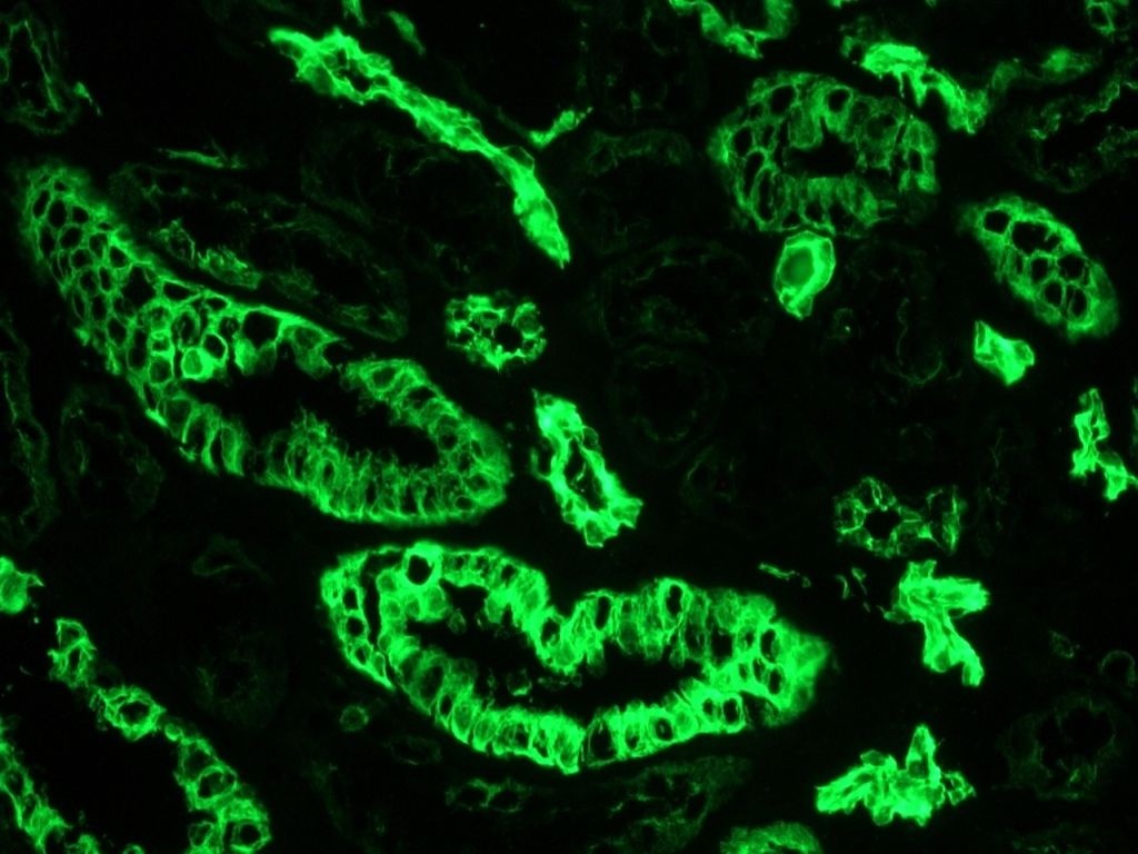 Mouse Cytokeratin 7 / Keratin K7 Antibody