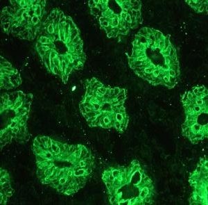 Mouse anti Cytokeratin 18 / Keratin K18