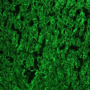 Mouse anti Cytokeratin 18 / Keratin K18