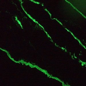 Mouse anti Cytokeratin 18 / Keratin K18