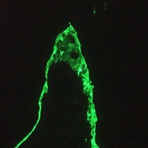 Mouse anti Cytokeratin 18 / Keratin K18