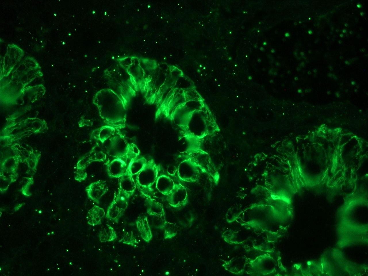 Mouse anti Cytokeratin 18 / Keratin K18