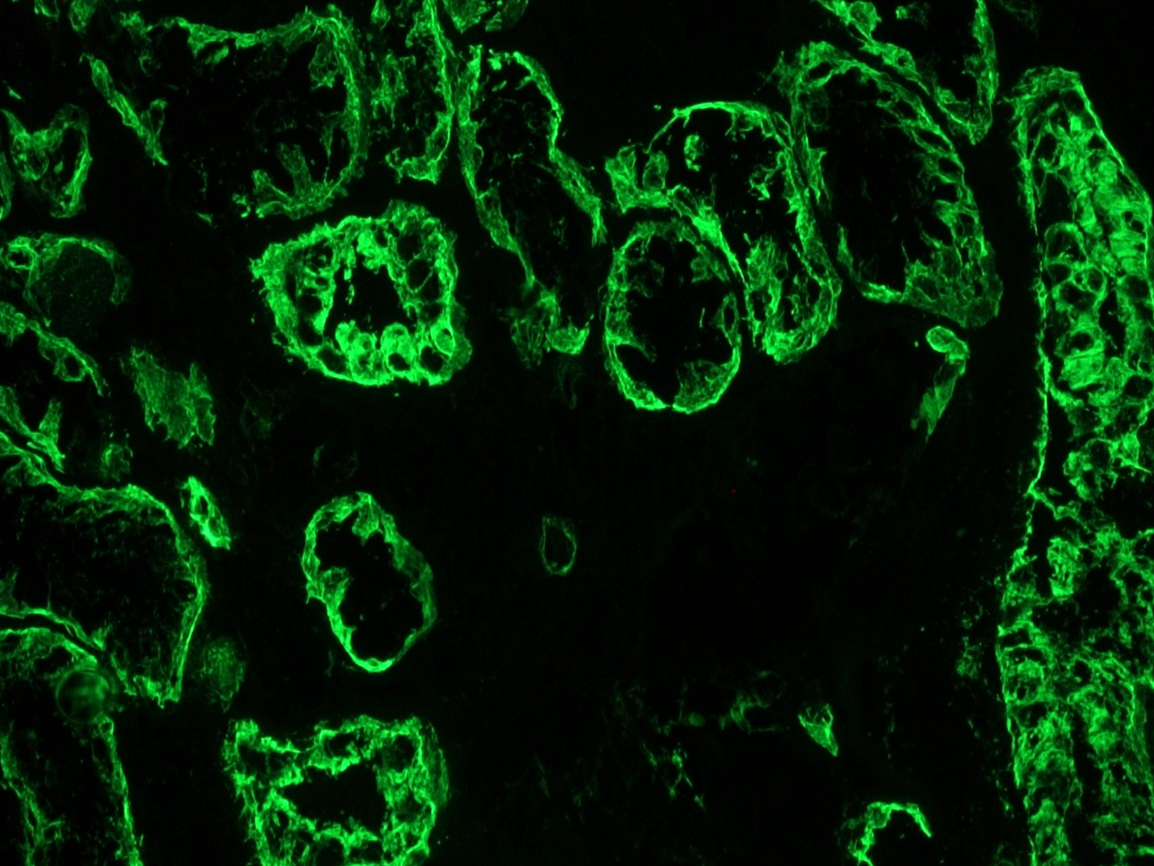 Mouse anti Cytokeratin 19 / Keratin K19