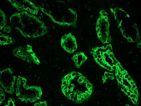 Mouse anti Cytokeratin 19 / Keratin K19