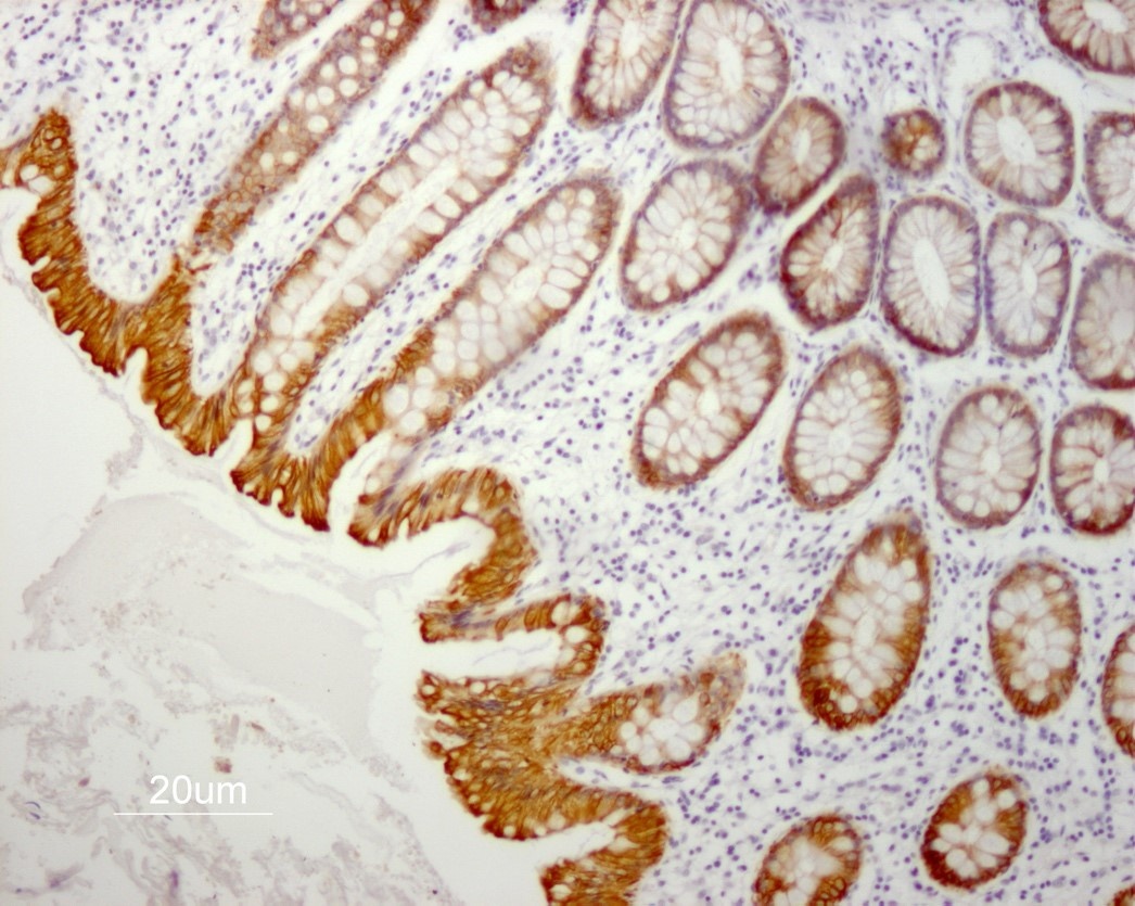 Mouse anti Cytokeratin 19 / Keratin K19