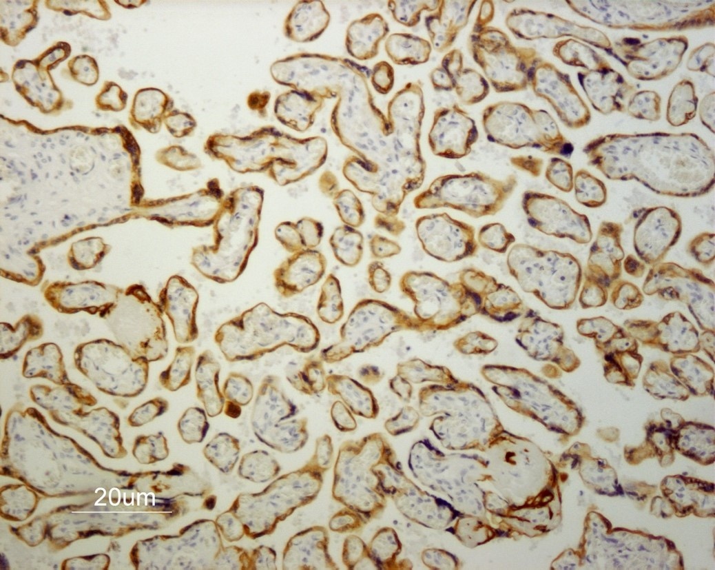 Mouse anti Cytokeratin 19 / Keratin K19