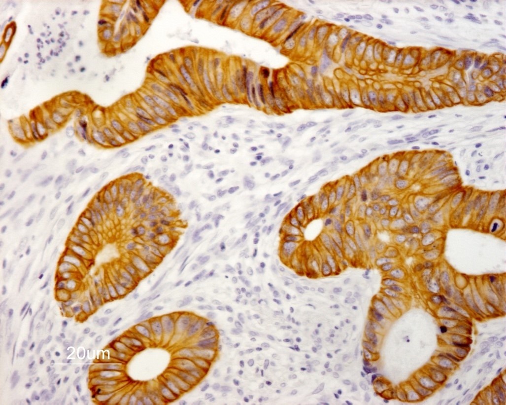 Mouse anti Cytokeratin 19 / Keratin K19