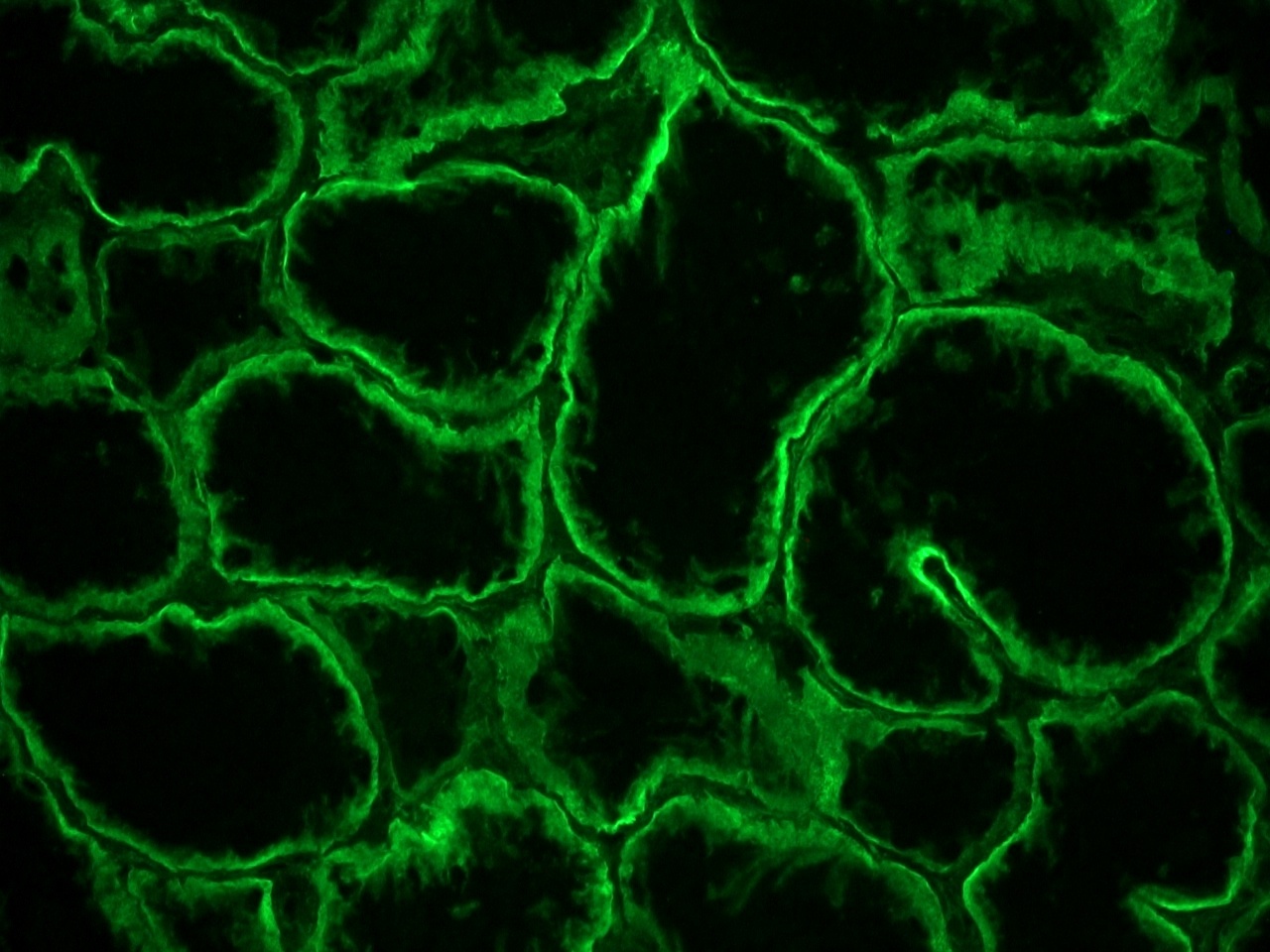 Rat anti Integrin alpha 6A / CD49f