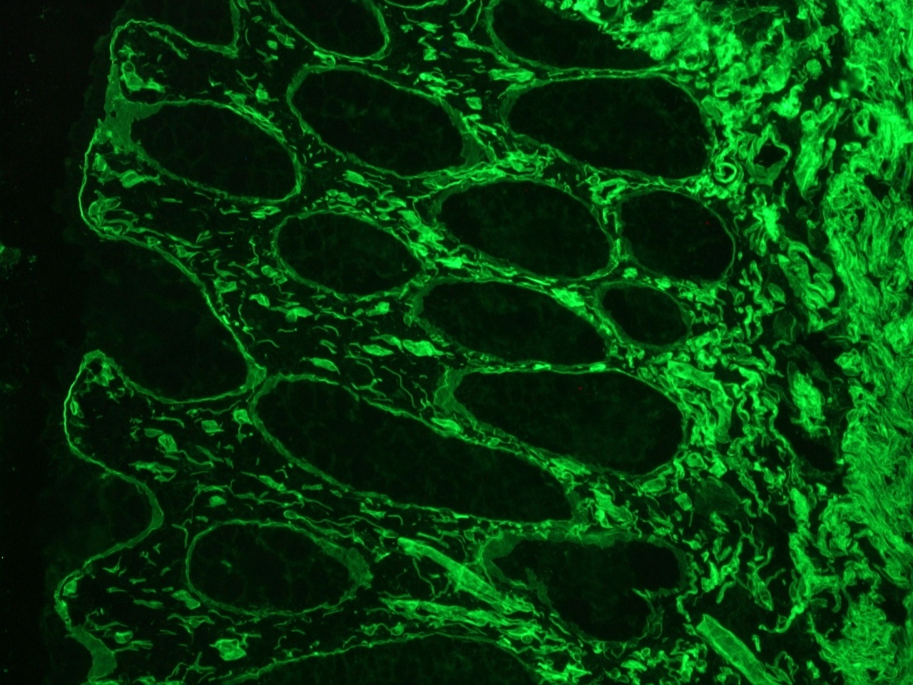 Rat Laminin Antibody