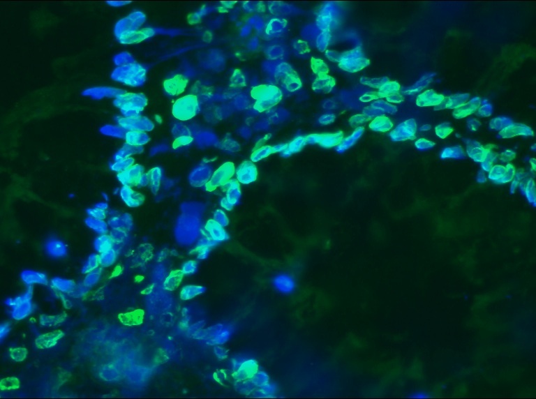 Lamin A and C antibody