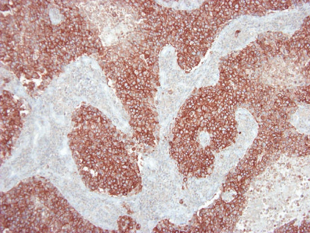 Mouse Neu-Oncogen (C-erb B2) Antibody