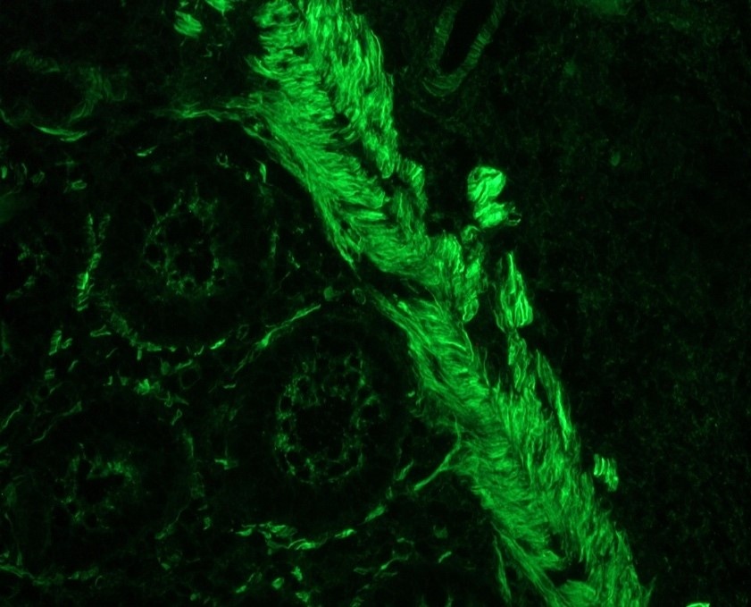 Smoothelin antibody