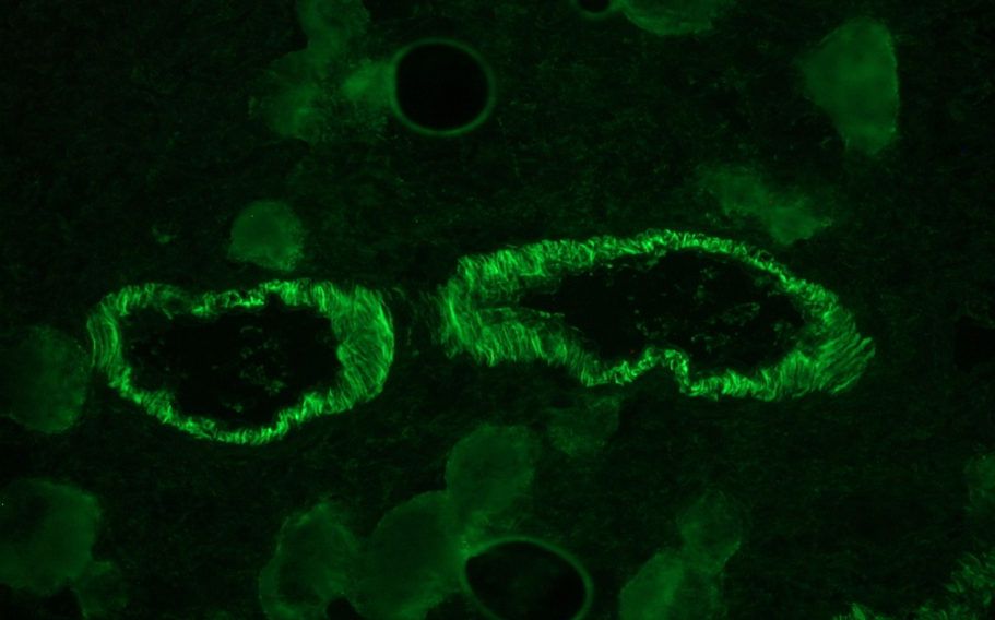 Smoothelin antibody