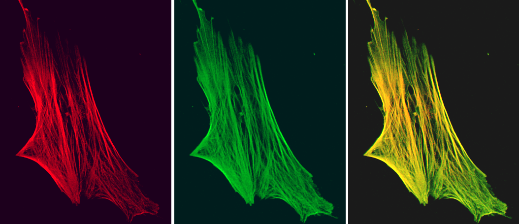 Smoothelin antibody