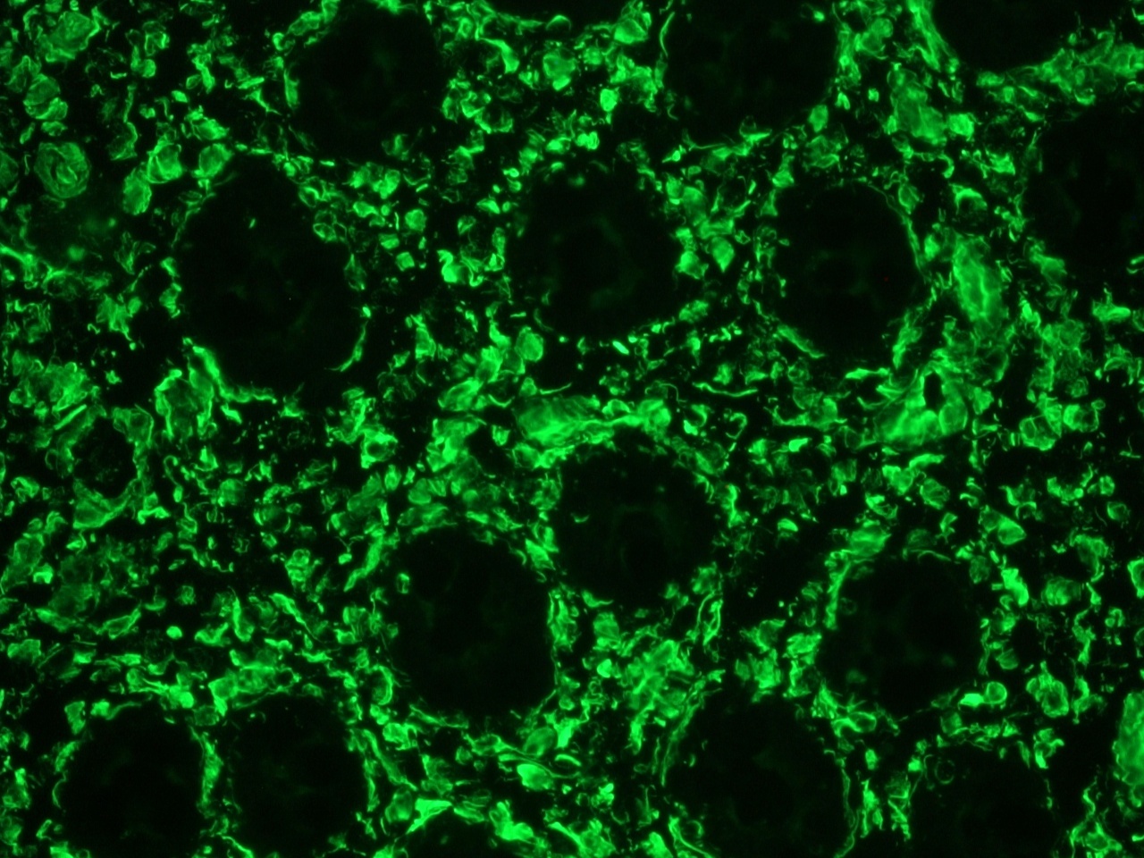 Mouse Vimentin Antibody