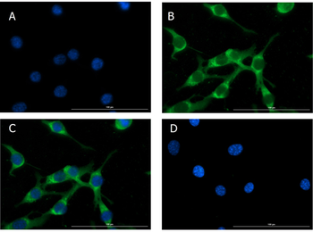 Glucagon Antibody