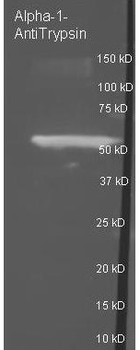 Alpha-1-Anti-Trypsin Antibody