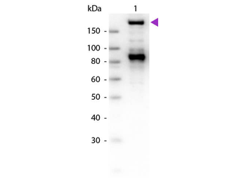 Alpha-2-Macroglobulin Antibody