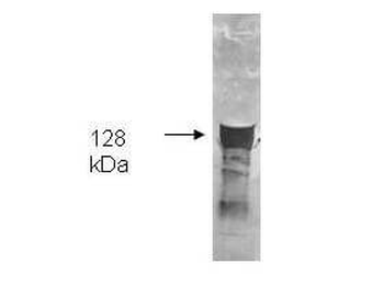 Glycerol Kinase Antibody