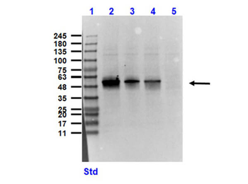 Sucrose Phosphorylase Antibody