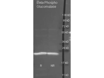 pgmB Antibody