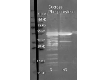 Sucrose Phosphorylase Antibody Peroxidase Conjugated