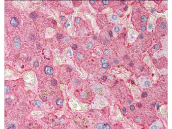 Fibrinogen Antibody Peroxidase Conjugated