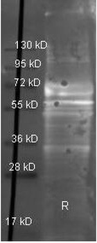 Fibrinogen Antibody Peroxidase Conjugated