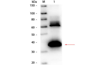 Anti-Uricase Antibody Biotin Conjugated